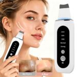 Ultrasonic 28kHz Skin Scrubber Spatula - Image 2