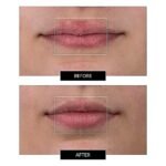 Flexible Silicone LED Light Lip Plumper Mask - Image 5