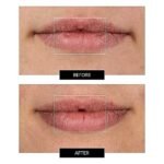 Flexible Silicone LED Light Lip Plumper Mask - Image 6